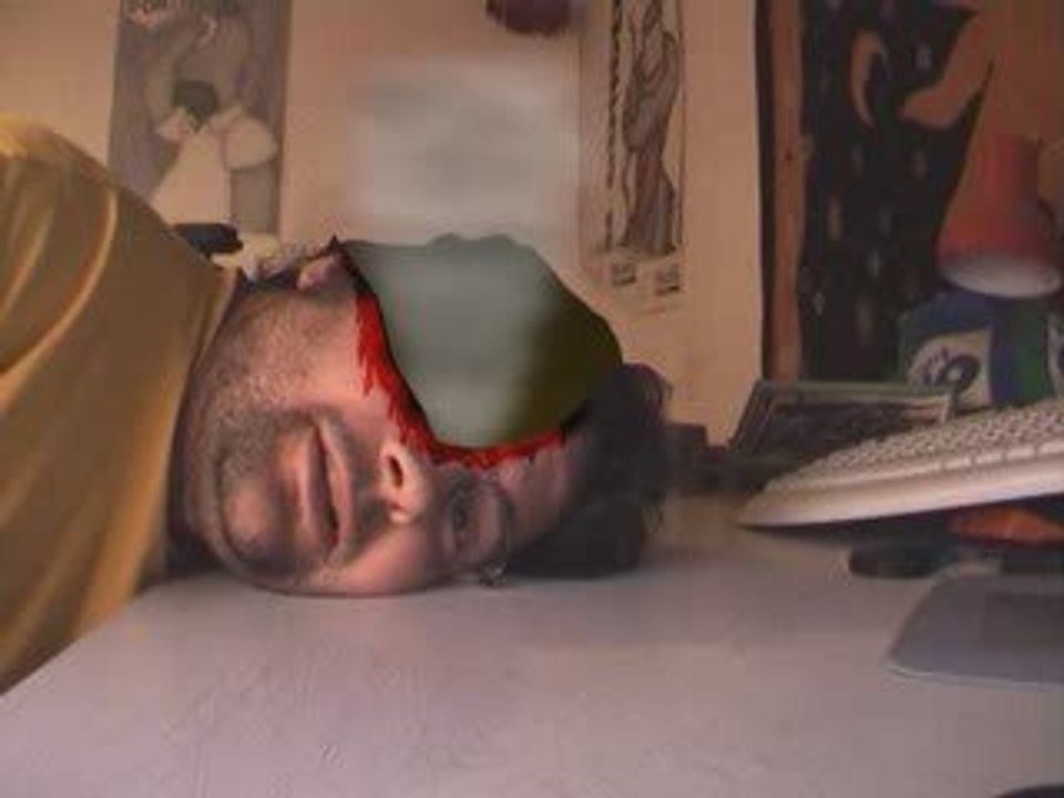 Mal a la tete