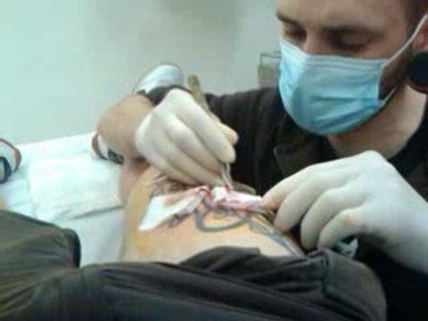 scarification pedro