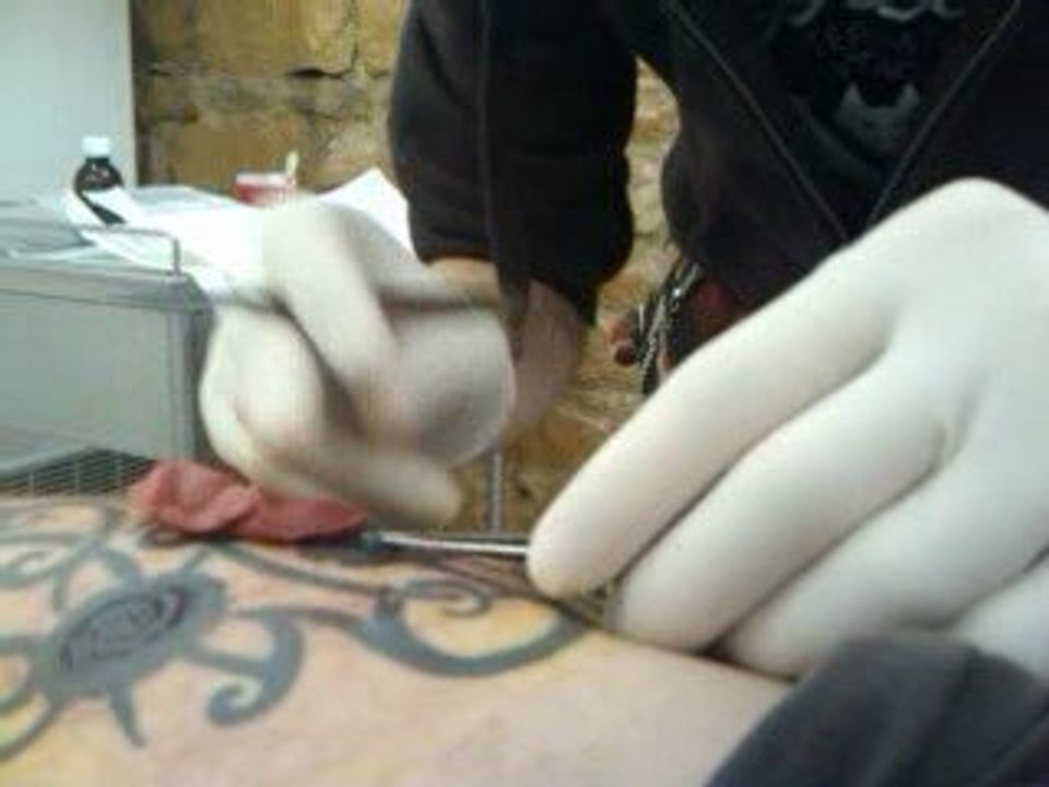 scarification pedro2