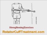 3 Powerful Rotator Cuff Treatment Exercises