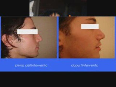 Giuseppe Sito o l'arte della bellezza