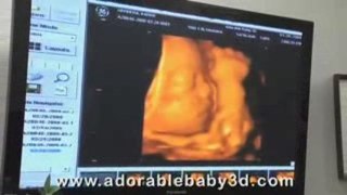 Adorable Baby 3D/4D Ultrasound