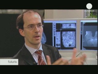 Bataille numérique contre le cancer du sein