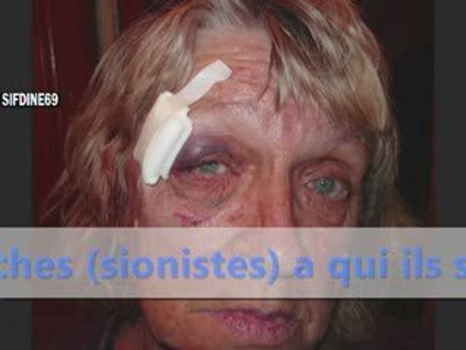 les laches du batard!!!