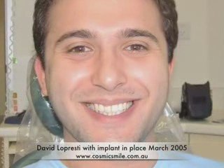 Implant Dentist Sydney Australia|Mini Implant Dentist