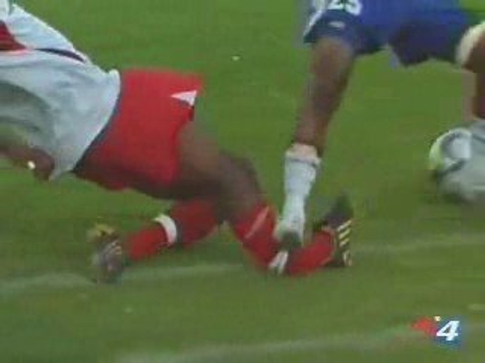 choc : jambe brisée en deux football AME SENSIBLE S'ABSTENIR