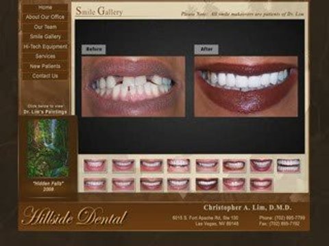 Las Vegas Invisalign Dentist