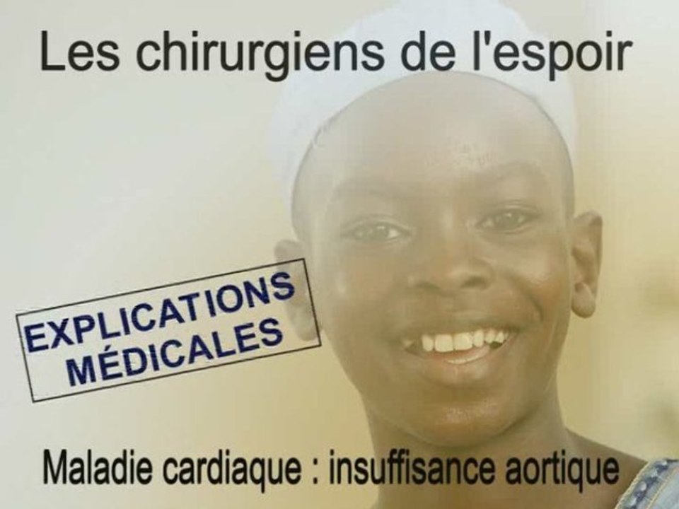 Insuffisance aortique : explication vidéo