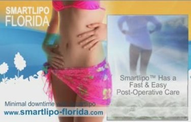 smart lipo florida