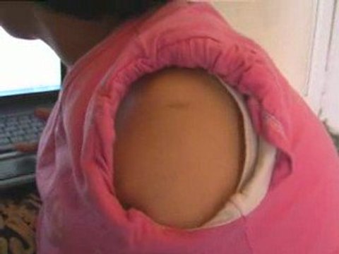 ŞEMDİNLİ DOĞUŞTAN KOLLARI OLMAYAN RABİA İNAN/IN DRAMI