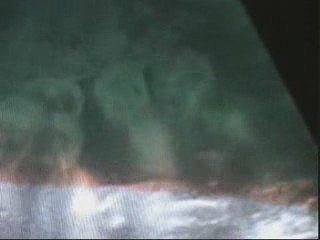 FILM échographie du 08 juin 2009