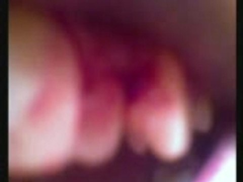 1 punch = 7 chipped tooths, and blood