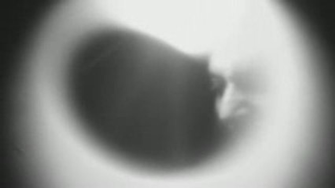 Chrysalide