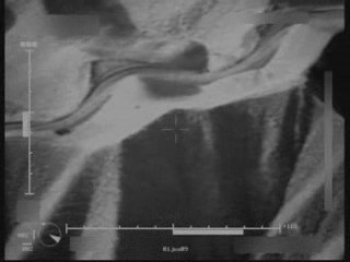 L'opération Bloodhound vue du ciel