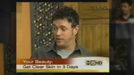 Pimple Remedies - Acne Free in 3 Days