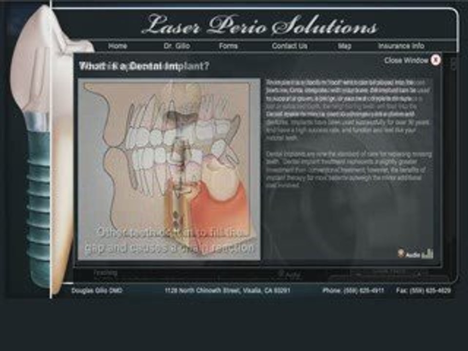 Visalia Laser Dentist
